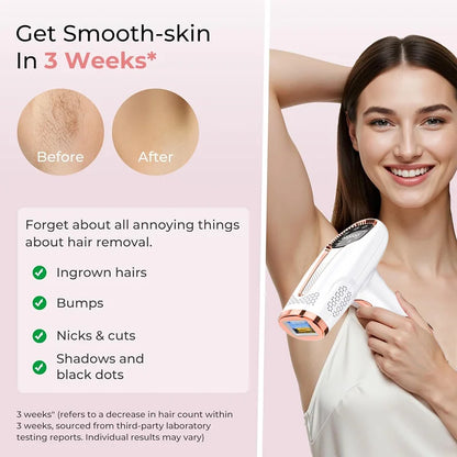 Permanent IPL Laser Hair Removal – Painless Salon-Grade Results at Home