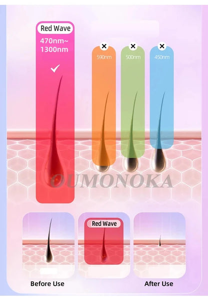 Permanent IPL Laser Hair Removal – Painless Salon-Grade Results at Home