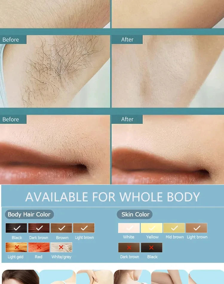 500,000-Flash Permanent IPL Laser Hair Removal – Painless Salon-Grade Results at Home