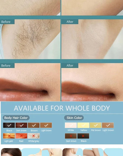 500,000-Flash Permanent IPL Laser Hair Removal – Painless Salon-Grade Results at Home