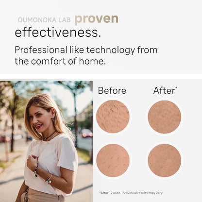 Permanent IPL Laser Hair Removal – Painless Salon-Grade Results at Home